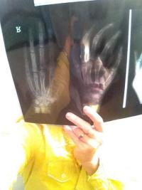 radio-autoportrait 1