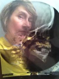 radio-autoportrait 2