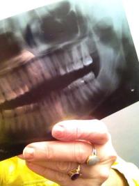 radio-autoportrait 3